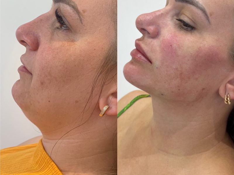 9D713A60-6FDD-4147-9F2C-BF6DB36E4766