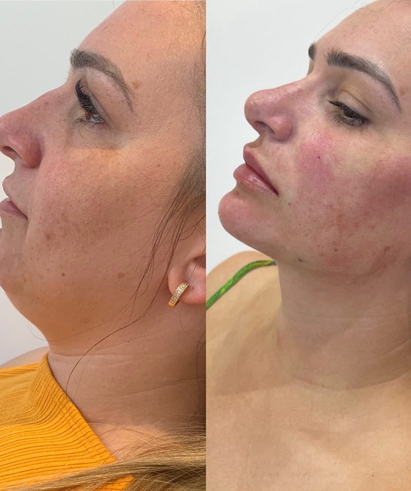 9D713A60-6FDD-4147-9F2C-BF6DB36E4766