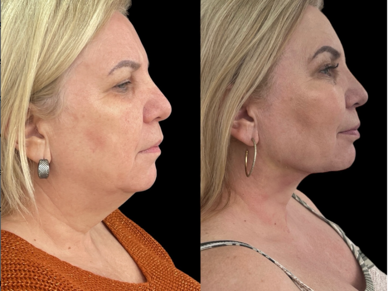 Captura de tela 2024-05-21 222329